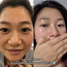 泰國🇹🇭yanhee醫用美白霜– 泰國🇹🇭Beauty彩妝護膚Debbie Ben站