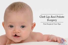 Maybe you would like to learn more about one of these? Cleft Lip And Palate Surgery Post Surgical Care Tips