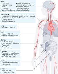 Image result for Mild PIH Management