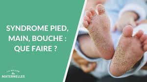 Il s'agit de taches rouges centrées par une petite vésicule. Le Syndrome Pied Main Bouche Pmb Pediatre Online