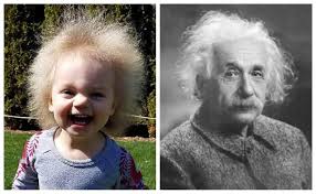 Einstein dianugrahi penghargaan nobel dalam fisika pada tahun 1921 untuk pengabdianya bagi fisika teoretis. Isu Semasa Dalam Dan Luar Negara Hidapi Sindrom Rambut Bayi Ini Tercacak Seperti Albert Einstein