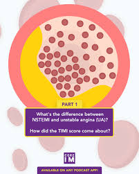 Image result for Unstable Angina