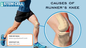 Pin On Knee Pain Joints Arthritis In Nyc