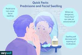 Lastly, just like with every cycle, you need to clear your kidneys to get rid of the water retention. Facial Swelling Caused By Prednisone