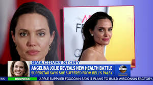 Her voluntary surgeries to prevent cancer pushed her into menopause. Watch Angelina Jolie Reveals New Good Morning America