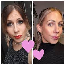 Daisy's story is my most favorite out of all the RF transformations ❤️😍  Think you're too old to achieve great skin results⁉️ Think you're too old  to start a business⁉️ This is