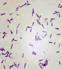 Tetani spores are extremely hardy and can be found globally in soil or in the gastrointestinal tract of animals. Detection Of Clostridium Tetani In Human Clinical Samples Using Tetx Specific Primers Targeting The Neurotoxin Sciencedirect