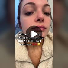 The one good thing #fyp #accutane #accutanecheck #acne #accutane #a...