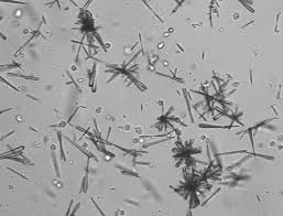 Pin On Urine Cryst