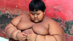 Un Indonesio De 10 Anos Es El Nino Mas Gordo Del Mundo Con 192 Kilos