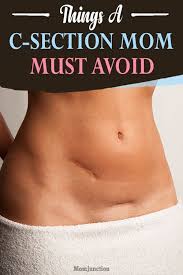 19 Things A C Section Mom Must Avoid C Section C Section Workout C Section Recovery