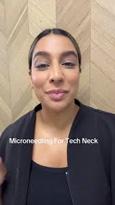 #stitch with @HiSavRi Microneedling works for tech neck! Also called Neck  bands, these lines form around the neck area. Microneedling will stimulate  collagen and I’m able to target these lines with a ...