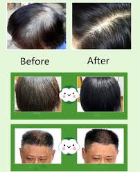 Buy Dexe Instant Hair Dye Black Hair Shampoo 10 Packs Hair Dye Obs