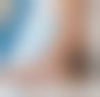 Image result for toe black diabetes