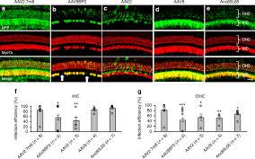 Recessed lighting installation necrosis pictures heeler. Aav2 7m8 Infects Cochlear Inner And Outer Hair Cells With High Download Scientific Diagram