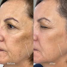 Cosmetic Tattoo Art by Sibina