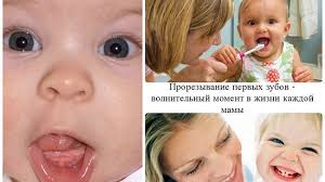 может ли быть температура у ребенка при прорезывании зубов Zuby Lezut Ne Po Poryadku Chto Delat