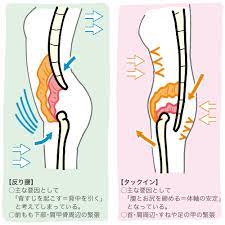 反り腰 と タックイン 腰 筋肉 筋肉のフィットネス 腸腰筋