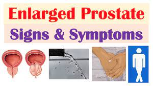 Maybe you would like to learn more about one of these? Enlarged Prostate Signs Symptoms Why They Occur Youtube