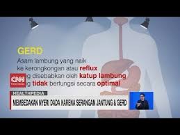 Untuk memastikan apakah dikarenakan adanya penyakit lain, kita disarankan untuk memeriksakan diri … Membedakan Nyeri Dada Karena Serangan Jantung Dan Gerd Youtube