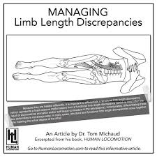 Image result for Functional Leg Length Discrepancy