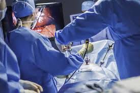 Maybe you would like to learn more about one of these? Soalan Soalan Lazim Untuk Pembedahan Laparoscopy