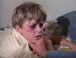 Thrilling Days of Yesteryear: Doris Day(s) #8: “The Black Eye” (11/26/68,  prod. no #8501)