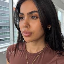 The Art of Dark Lip Neutralization Dark lip neutralization is a cosmetic  procedure aimed at correcting uneven pigmentation or discoloration of the  lips. This technique is particularly useful for individuals who have