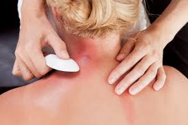 The latissimus dorsi muscles (also known as the lats) are the largest muscles of the back. Gua Sha Scraping Of Back Is Said To Relieve Pain And Ease Other Medical Problems The Washington Post