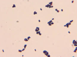 Saprophyticus) species.streptococcus bacteria subdivide into strep. Pin On Microbiology