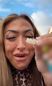 A mum from the UK went viral after flying to Turkey to get veneers 😳  #reels #hookedonthelook #plasticsurgery #veneers #turkeyteeth