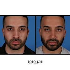 Dr. Totonchi Plastic Surgery