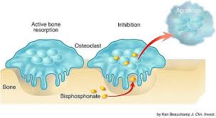 Image result for Bisphosphonates