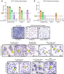 Looking for the definition of qv? Infectious Titres Of Human Papillomaviruses Hpvs In Patient Lesions Methodological Considerations In Evaluating Hpv Infectivity And Implications For The Efficacy Of High Level Disinfectants Ebiomedicine