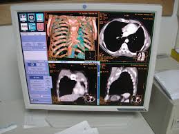 Ct pelvis nativ şi cu substanţă de contrast administrata intravenos. Ct Computer Tomograf Ce Este PregÄƒtire Cum Decurge ContraindicaÈ›ii