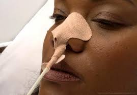 Dale Nasogastric Tube Holder Large Adult