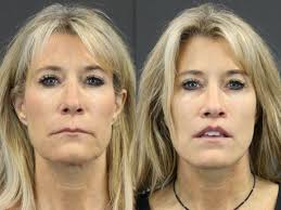 TOP 10 BEST Eye Clinic in Bedford Park, IL