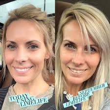 What skincare regimen can give these results in 6 weeks?