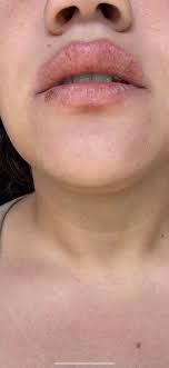 Do any of you get burning in your legs, tingling in your legs and muscle  spasms? Spoke to my rheumatologist yesterday and even though my TPO is 650  and it keeps climbing