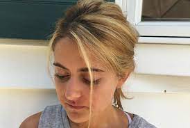 Receding Hairline In Women Causes Treatment Young Black Women Receding Front Hairline Natural Remedies