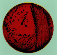 Image result for Corynebacterium