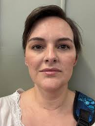 I made a face in blender and when I look at it in blender it's fine but  then when I render it there's black lines going down the face. Can anybody  suggest