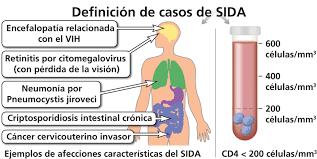 Image result for Sida