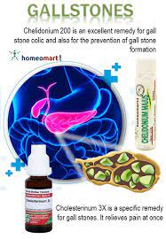 Doctor Recommended Homeopathy Medicines For Gallstone Treatment