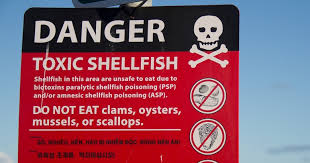 Image result for Amnesic Shellfish Poisoning