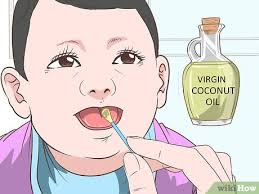 3 Formas De Eliminar A Candidiasis Bucal En Bebes