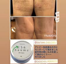 イチコロバーム まもなく新登場 肘 肘裏首など季節の変わり目や汗の刺激などで肌がボロボロになっていませんか 薬を使うと魔法のようにきれいになりますよね でも塗り続け 詳しくは http medicalsakurasou jp 74989 p 5432 fwtype スキンケアアイテム