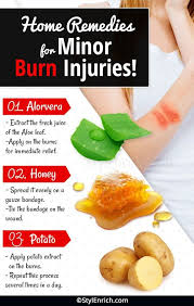 Sign In Home Remedies For Burns Natural Remedies Natural Health Remedies