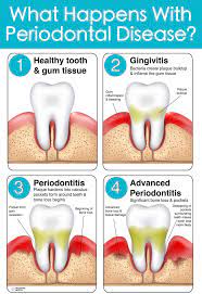 Pin On General Health