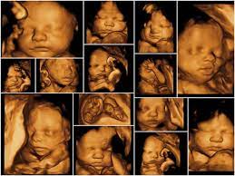 How to get best 3d ultrasound pics? 3d 4d Ultrasound Southern Ob Gyn Associates